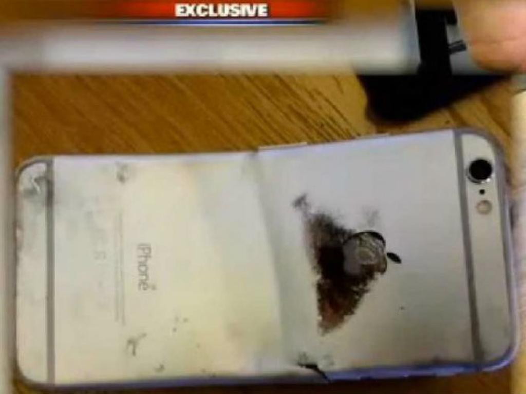 Un hombre de Phoenix, Arizona, sufrió quemaduras de segundo grado cuando su iPhone se encendió en su pantalón. Foto: Fox10