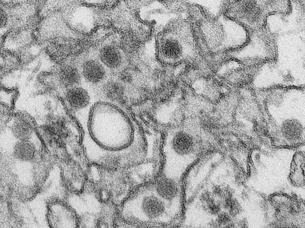 El virus de Zika está relacionado con una deformación fetal conocida como microcefalia, en la que los bebés nacen con un cerebro más pequeño de lo normal. Foto: Reuters.