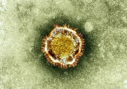 La Organización Mundial de la Salud (OMS) declaró al COVID-19 (coronavirus) como una pandemia global. Foto: Reuters 