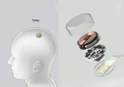 Elon Musk presentó e hizo una demostración de su proyecto Neuralink. Foto: *Neuralink.