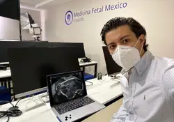 El estudiante Imanol Darán desarrolló una solución tecnológica que mejora el diagnóstico de diferentes enfermedades identificadas en estudios médicos como los ultrasonidos. Foto: *Tec de Monterrey.