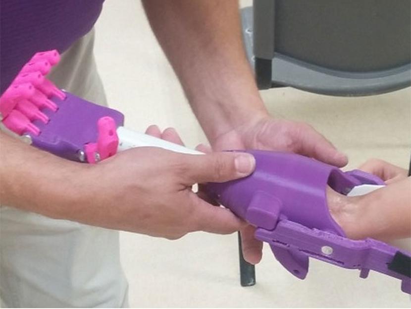 Crean mano robótica para una niña gracias a la impresión 3D. Foto Especial