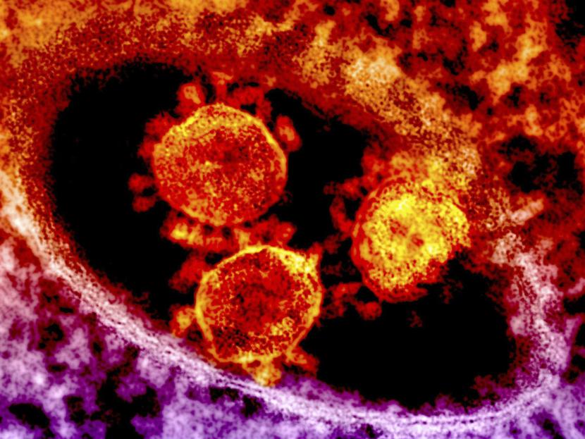Este martes en China se confirmó la sexta muerte por el brote del coronavirus. Foto: Reuters 
