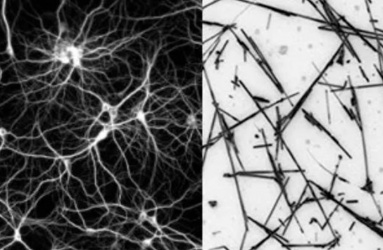 Científicos de Japón han comprobado que al mantener esta red de nanocables en un estado cerebral 