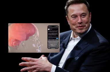 Así funciona el primer chip cerebral de Elon Musk que controla dispositivos con la mente. Foto: Reuters.